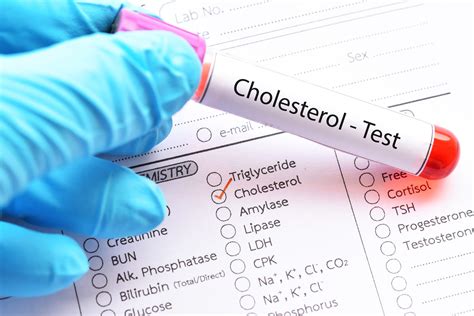 taking a blood test in the morning impact hdl cholesterol|what is a cholesterol test.